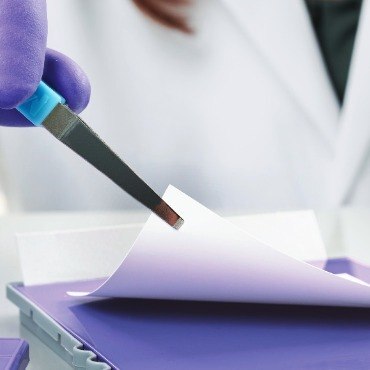 Transfer of proteins to PVDF membrane for detection using Western blotting techniques.