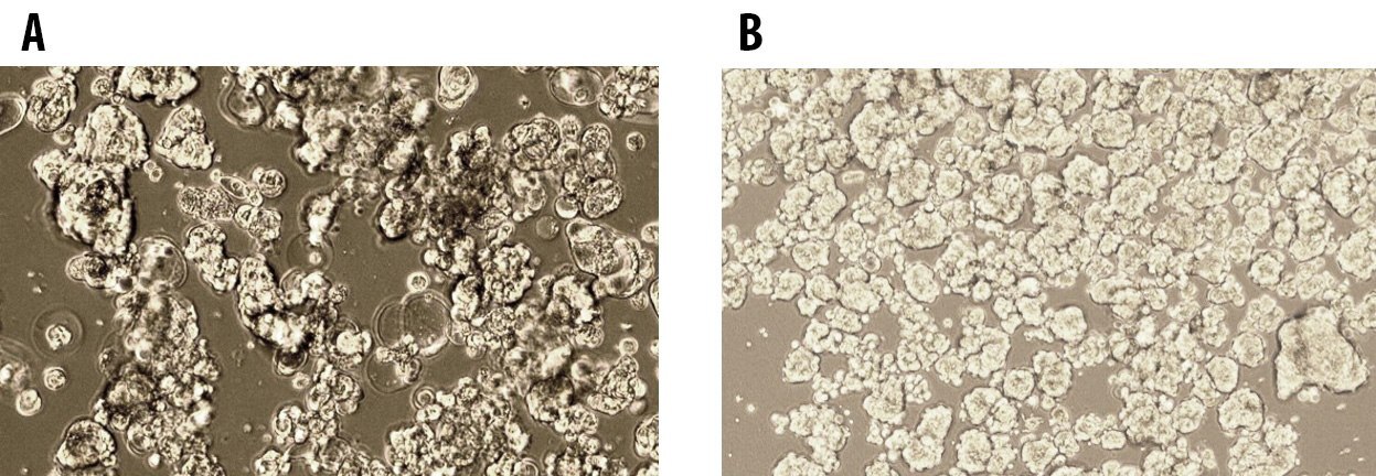 Tumorsphere formation of MCF7 Breast Cancer Cells at Passage