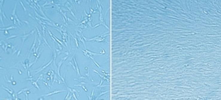 ECM matrix coating enables rapid expansion of fetal lung fibroblasts