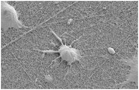 NG108 neuronal cells growing on an Ultra-Web nanofiber surface