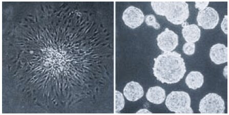 Single cell derived colonies of C6 glioma cells form flattened attached colonies in a standard tissue culture treated vessel (left panel) but form unattached spheroids on the Corning Ultra-Low Attachment surface (right panel)