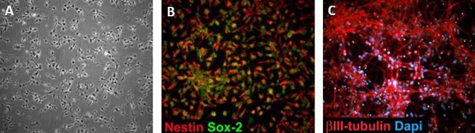 Human iPSC derived neural stem cells