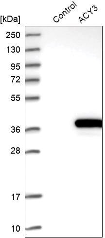 Expression/Overexpression Validation