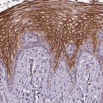 Anti-NUDT3 antibody produced in rabbit Prestige Antibodies&#174; Powered by Atlas Antibodies, affinity isolated antibody, buffered aqueous glycerol solution