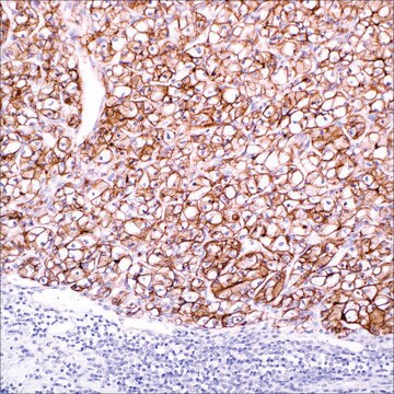 Carbonic Anhydrase IX (CA IX) (EP161) Rabbit Monoclonal Primary Antibody