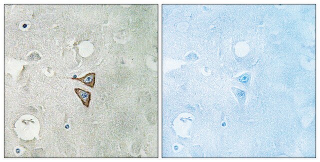 Anti-Opioid Receptor-&#948; antibody produced in rabbit affinity isolated antibody