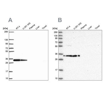 Anti-RPS3A antibody produced in rabbit Prestige Antibodies&#174; Powered by Atlas Antibodies, affinity isolated antibody