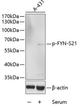 Anti-Phospho-FYN-S21 antibody produced in rabbit