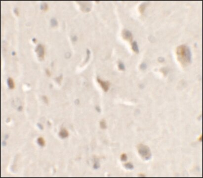 Anti-ULK1 antibody produced in rabbit affinity isolated antibody