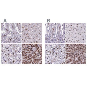 Anti-CD163 antibody produced in rabbit Prestige Antibodies&#174; Powered by Atlas Antibodies, affinity isolated antibody, buffered aqueous glycerol solution