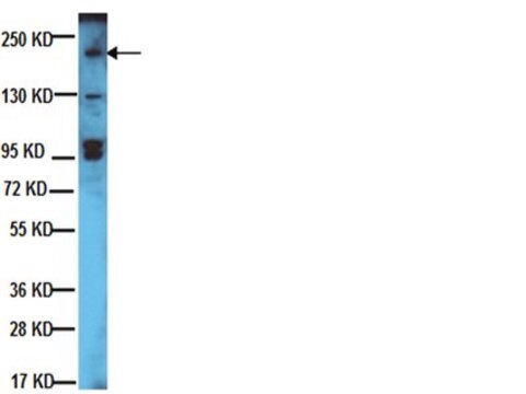 Anti-erbB-2/HER-2 Antibody Upstate&#174;, from rabbit