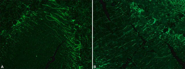 Anti-Neurofilament 200 antibody produced in rabbit IgG fraction of antiserum, buffered aqueous solution