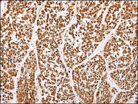 Anti-ABCA1 affinity isolated antibody