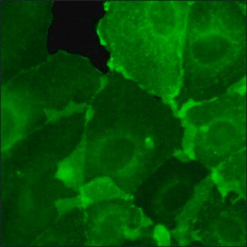 SKOV3 Cells GFP-HER2