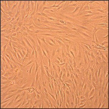 Human Osteoblasts-Osteoarthritis: HOb-OA, adult