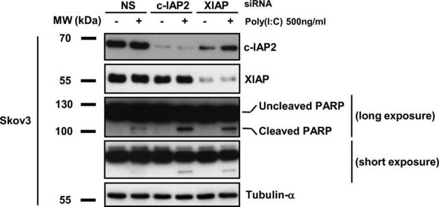 Monoklonaler Anti-&#945;-Tubulin-Antikörper in Maus hergestellte Antikörper clone B-5-1-2, ascites fluid