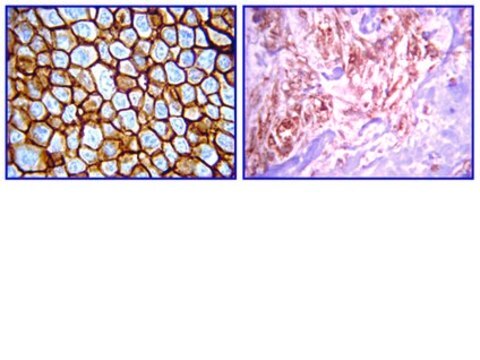 Anti-erbB4-Antikörper, Klon&nbsp;HFR1/2G4 clone HFR1/2G4, from mouse