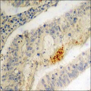 Anti-phospho-IRF-3 (pSer396) antibody produced in rabbit affinity isolated antibody