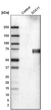 Monoclonal Anti-SOX11 antibody produced in mouse Prestige Antibodies&#174; Powered by Atlas Antibodies, clone CL0142, purified immunoglobulin, buffered aqueous glycerol solution