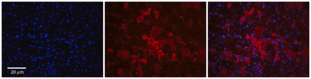 Anti-SLCO1A2 antibody produced in rabbit affinity isolated antibody