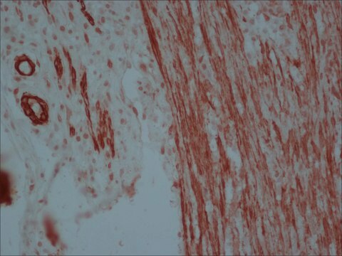 Anti-Maus-IgG (Fc-spezifische)-Peroxidase in Ziege hergestellte Antikörper affinity isolated antibody, buffered aqueous solution