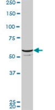 ANTI-FLI1 antibody produced in mouse clone 2D6, purified immunoglobulin, buffered aqueous solution