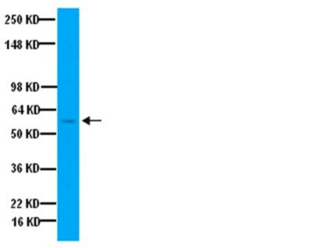 Anti-Tyrosin-Hydroxylase-Antikörper Chemicon&#174;, from sheep