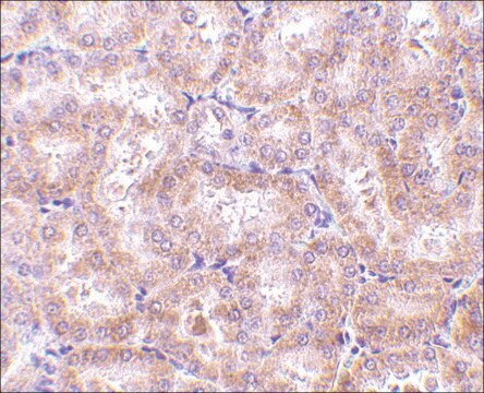 Anti-RIP3 antibody produced in rabbit affinity isolated antibody