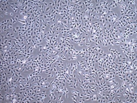 TC28a2 Human Chondrocyte Cell Line TC28a2 Human Chondrocyte Cell Line is widely used as a model cell line for studying normal and pathological cartilage repair mechanisms related to chondrocyte biology and physiology.