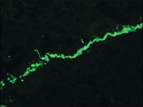 Anti-Collagen, Type VII antibody, Mouse monoclonal clone LH7.2, purified from hybridoma cell culture