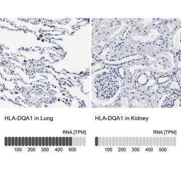 Anti-HLA-DQA1 antibody produced in rabbit Prestige Antibodies&#174; Powered by Atlas Antibodies, affinity isolated antibody, buffered aqueous glycerol solution