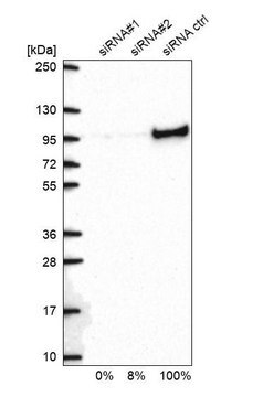 Anti-XRCC1 antibody produced in rabbit Prestige Antibodies&#174; Powered by Atlas Antibodies, affinity isolated antibody, buffered aqueous glycerol solution