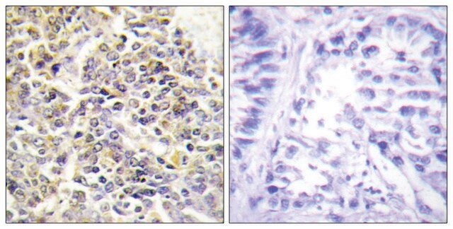 Anti-ASC antibody produced in rabbit affinity isolated antibody