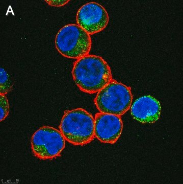 Anti-IL-6 Antibody, clone 3B9 ZooMAb&#174; Rabbit Monoclonal recombinant, expressed in HEK 293 cells