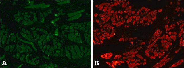 Anti-Myosin (Skeletal, Fast) antibody, Mouse monoclonal clone MY-32, purified from hybridoma cell culture