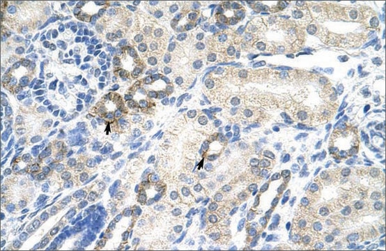 Anti-EZH2 antibody produced in rabbit affinity isolated antibody