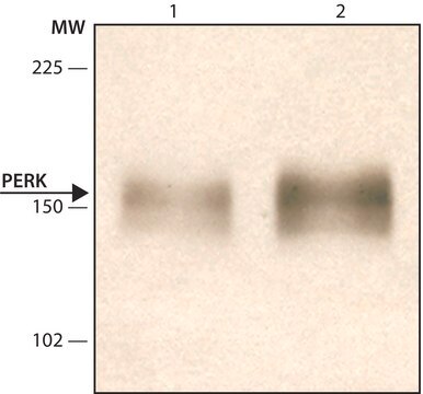 Anti-PERK (N-terminal) antibody produced in rabbit IgG fraction of antiserum, buffered aqueous solution