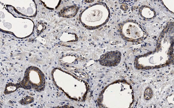 Anti-phospho-mTOR-(Ser2448) Antibody, clone 1C22 ZooMAb&#174; Rabbit Monoclonal recombinant, expressed in HEK 293 cells