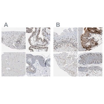 Anti-GRHL1 antibody produced in rabbit Ab2, Prestige Antibodies&#174; Powered by Atlas Antibodies, affinity isolated antibody, buffered aqueous glycerol solution