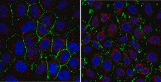 Anti-PSAT1 Antibody from rabbit, purified by affinity chromatography