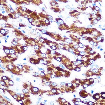 Anti-SERPINC1 antibody produced in rabbit