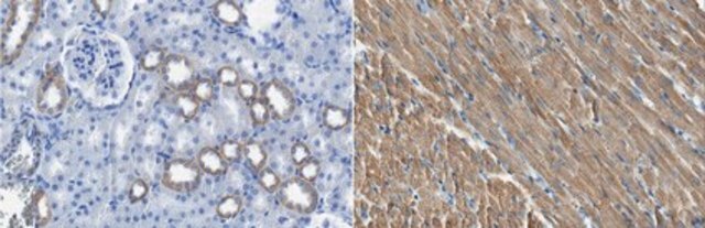 Anti-ARHGEF28 Antibody, clone 14C10.1 clone 14C10.1, from mouse