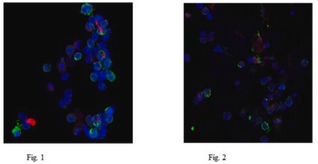 Anti-Neutrophil-Elastase-Antikörper, Klon AHN-10 clone AHN-10, from mouse