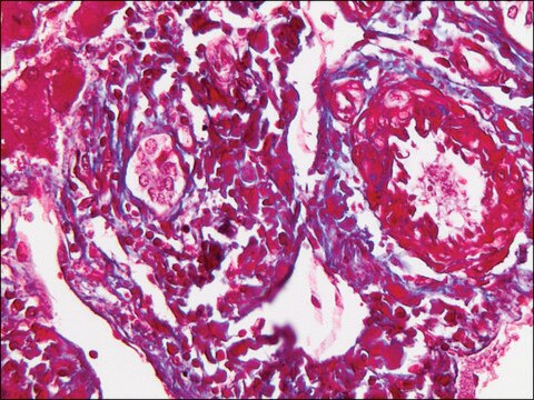 Trichrome Stain (Masson) Kit