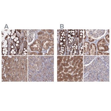 Anti-PEX13 antibody produced in rabbit Prestige Antibodies&#174; Powered by Atlas Antibodies, affinity isolated antibody, buffered aqueous glycerol solution