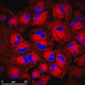 BioTracker TiY Vimentin Live Cell Dye Live cell imaging probe for identifying tumor initiating cells (TICs) in a variety of epithelial cancers, including lung cancer. The TiY probe binds to vimentin expressed in TICs.