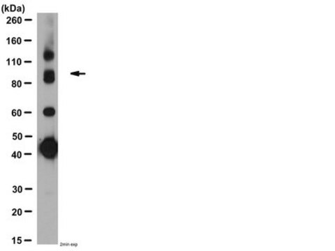 Anti-GABA-B-Rezeptor R1-Antikörper serum, from guinea pig