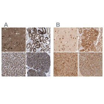 Anti-TMEM192 antibody produced in rabbit Prestige Antibodies&#174; Powered by Atlas Antibodies, affinity isolated antibody, buffered aqueous glycerol solution