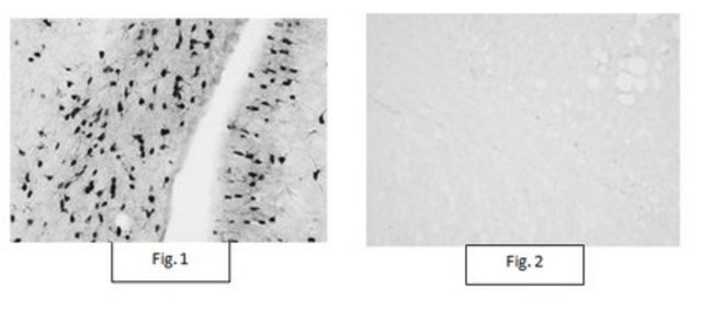 Anti-Aspa/Nur7 Antibody from rabbit, purified by affinity chromatography