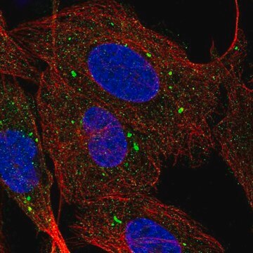 Anti-SCARB1 antibody produced in rabbit Prestige Antibodies&#174; Powered by Atlas Antibodies, affinity isolated antibody, buffered aqueous glycerol solution